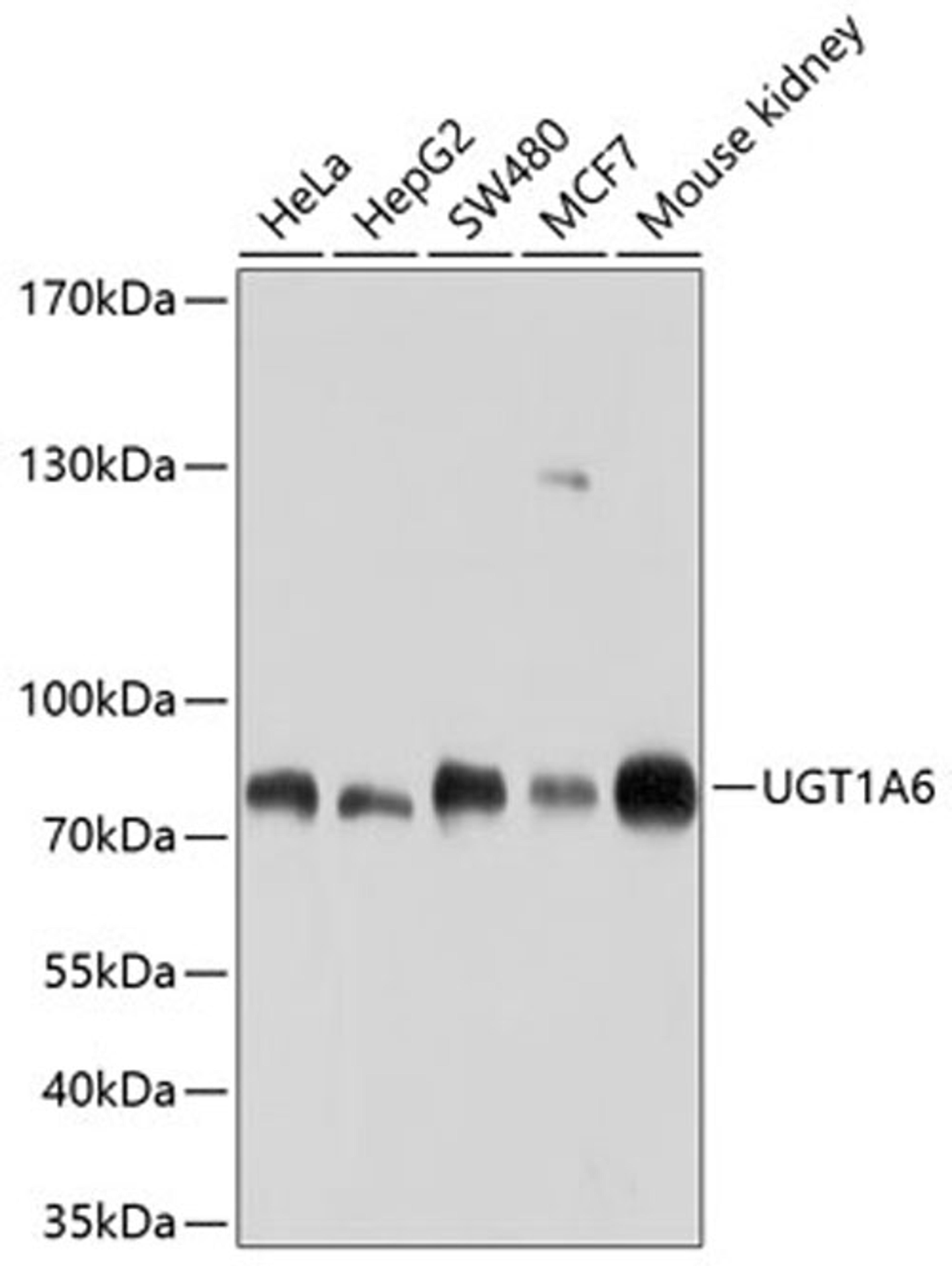 Western blot - UGT1A6 antibody (A10033)