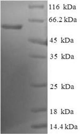 (Tris-Glycine gel) Discontinuous SDS-PAGE (reduced) with 5% enrichment gel and 15% separation gel.