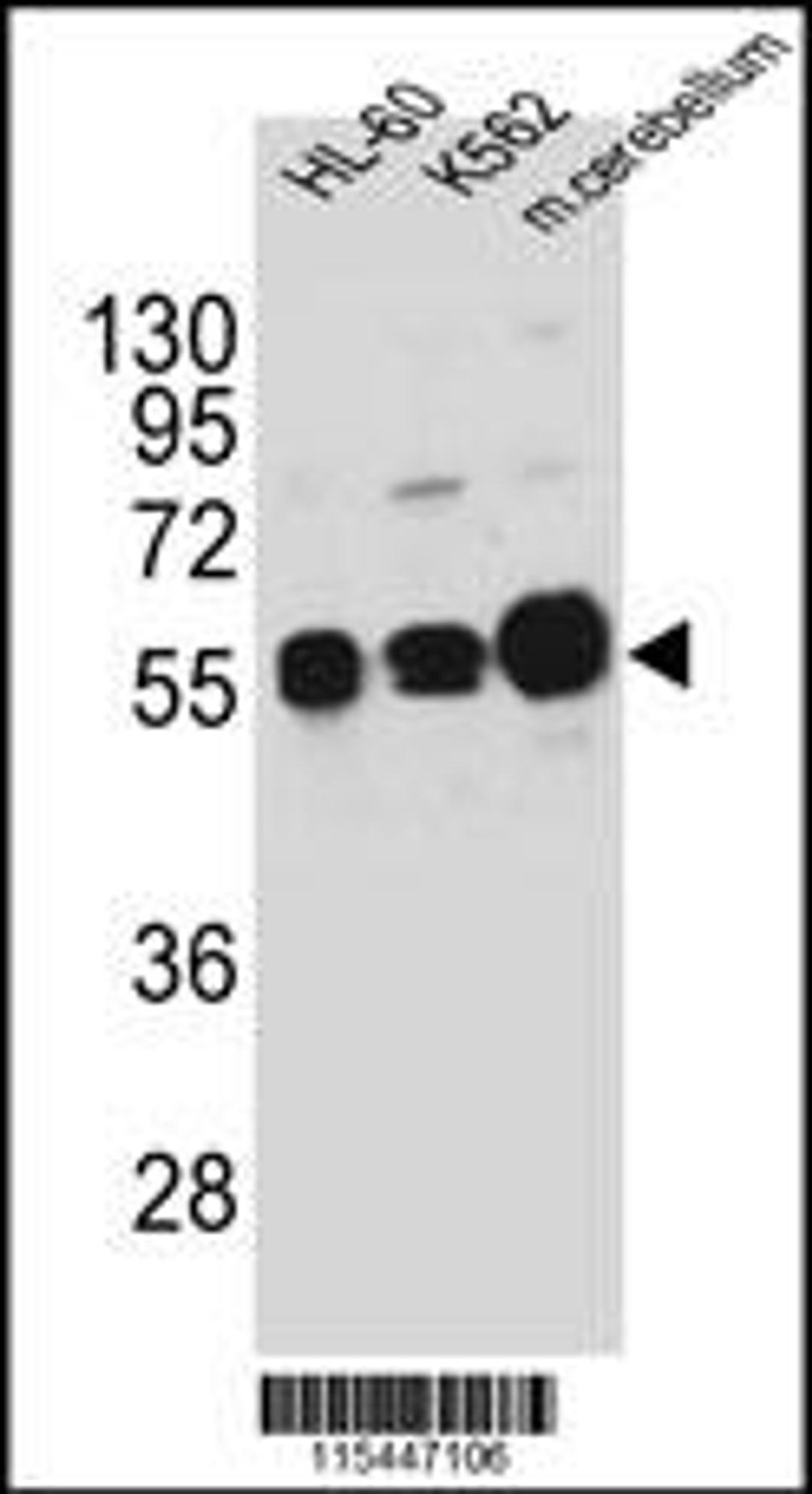 Western blot analysis in HL-60,K562 cell line and mouse cerebellum tissue lysates (35ug/lane).This demonstrates the CAMK1G antibody detected the CAMK1G protein (arrow).