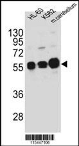 Western blot analysis in HL-60,K562 cell line and mouse cerebellum tissue lysates (35ug/lane).This demonstrates the CAMK1G antibody detected the CAMK1G protein (arrow).