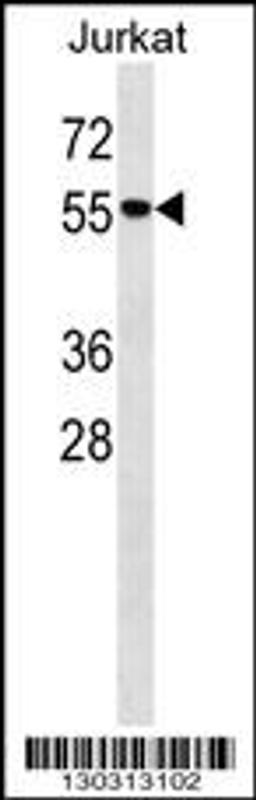 Western blot analysis in Jurkat cell line lysates (35ug/lane).