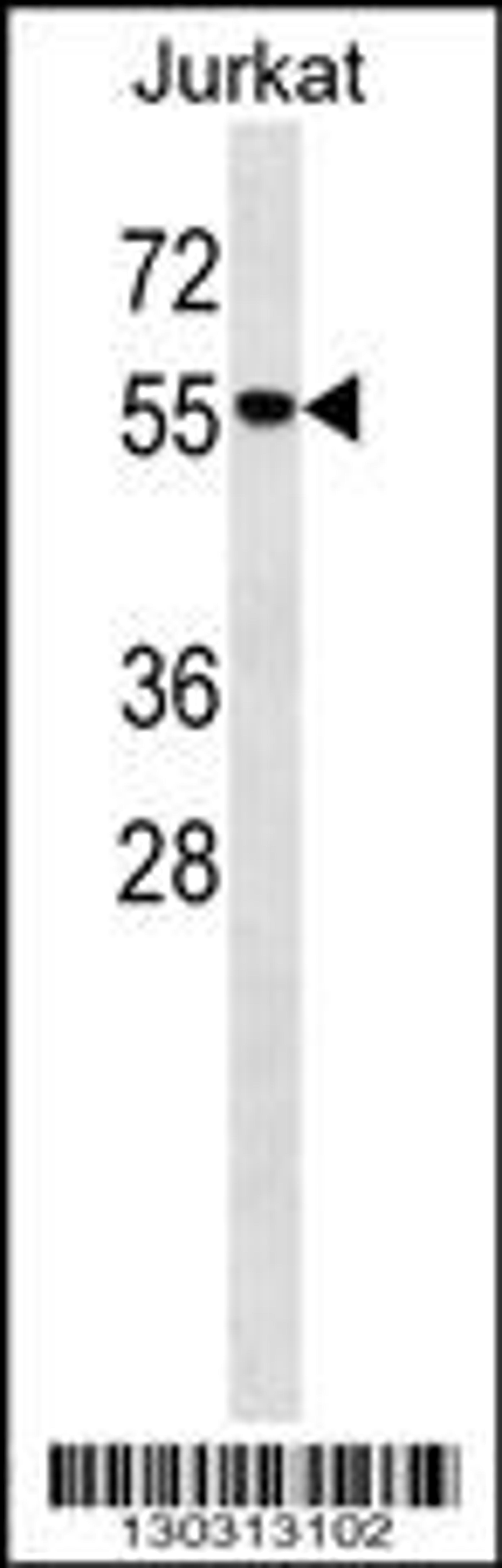 Western blot analysis in Jurkat cell line lysates (35ug/lane).