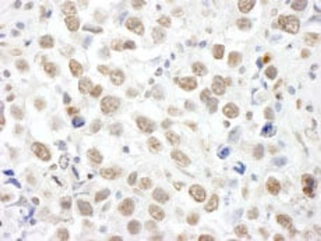 Detection of human TOPORS by immunohistochemistry.