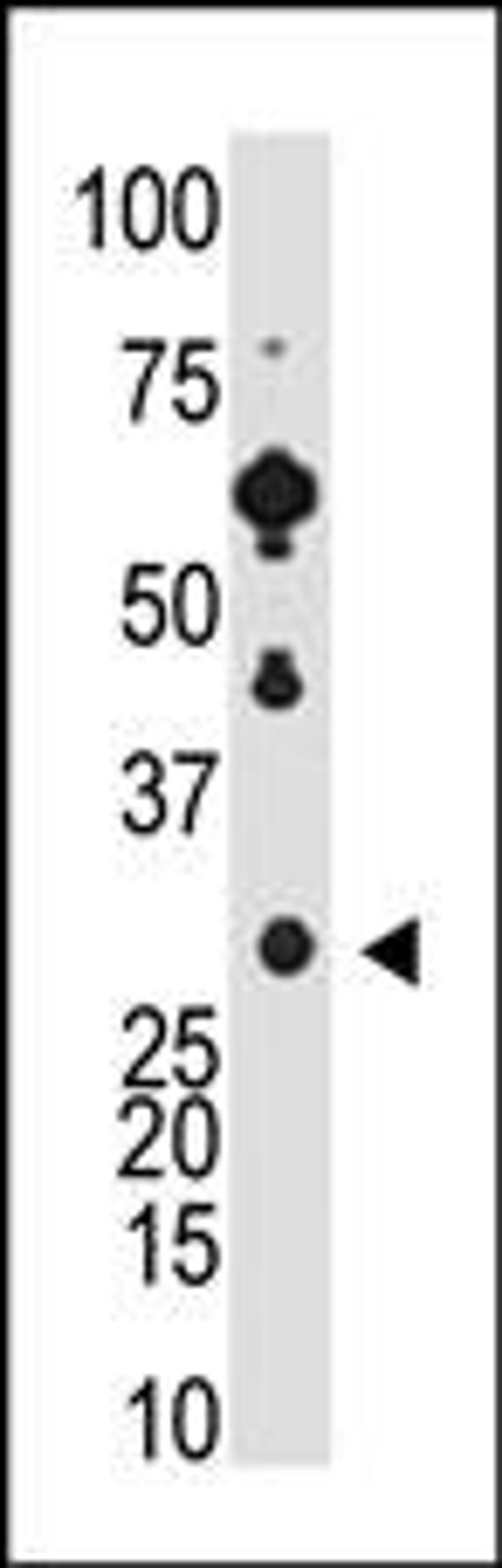 Antibody is used in Western blot to detect Recoverin in Y79 cell lysate.