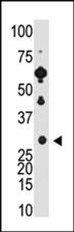 Antibody is used in Western blot to detect Recoverin in Y79 cell lysate.