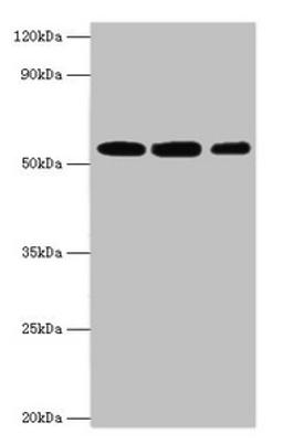 Western blot. All lanes: Nicotinamide phosphoribosyltransferase antibody at 4ug/ml. Lane 1: Mouse heart tissue. Lane 2: Mouse liver tissue. Lane 3: Mouse skeletal muscle tissue. Secondary. Goat polyclonal to rabbit IgG at 1/10000 dilution. Predicted band size: 56 kDa. Observed band size: 56 kDa.