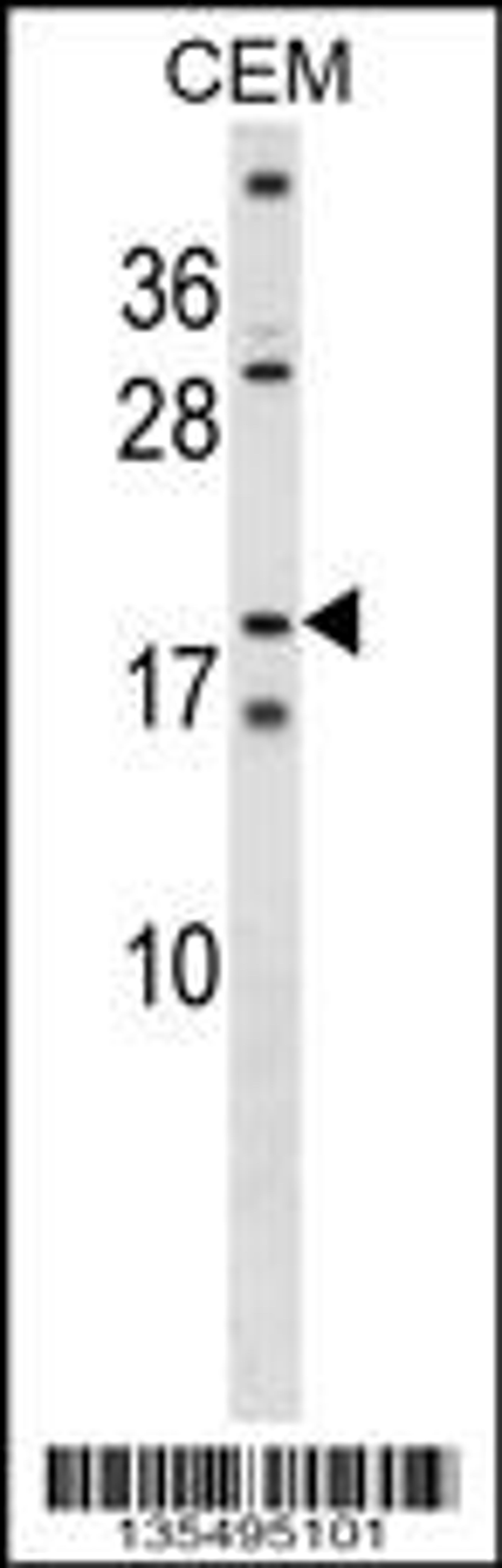 Western blot analysis in CEM cell line lysates (35ug/lane).