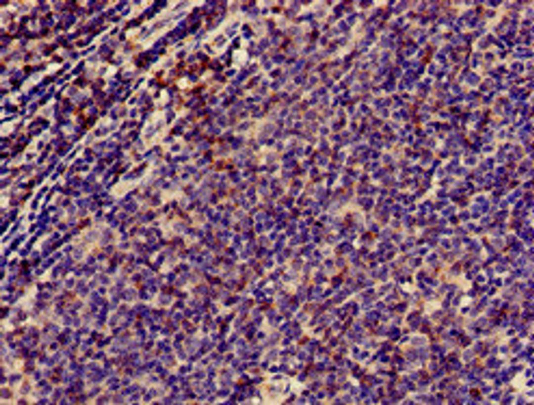 Immunohistochemistry of paraffin-embedded human lymph node tissue using CSB-PA004931HA01HU at dilution of 1:100