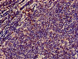 Immunohistochemistry of paraffin-embedded human lymph node tissue using CSB-PA004931HA01HU at dilution of 1:100