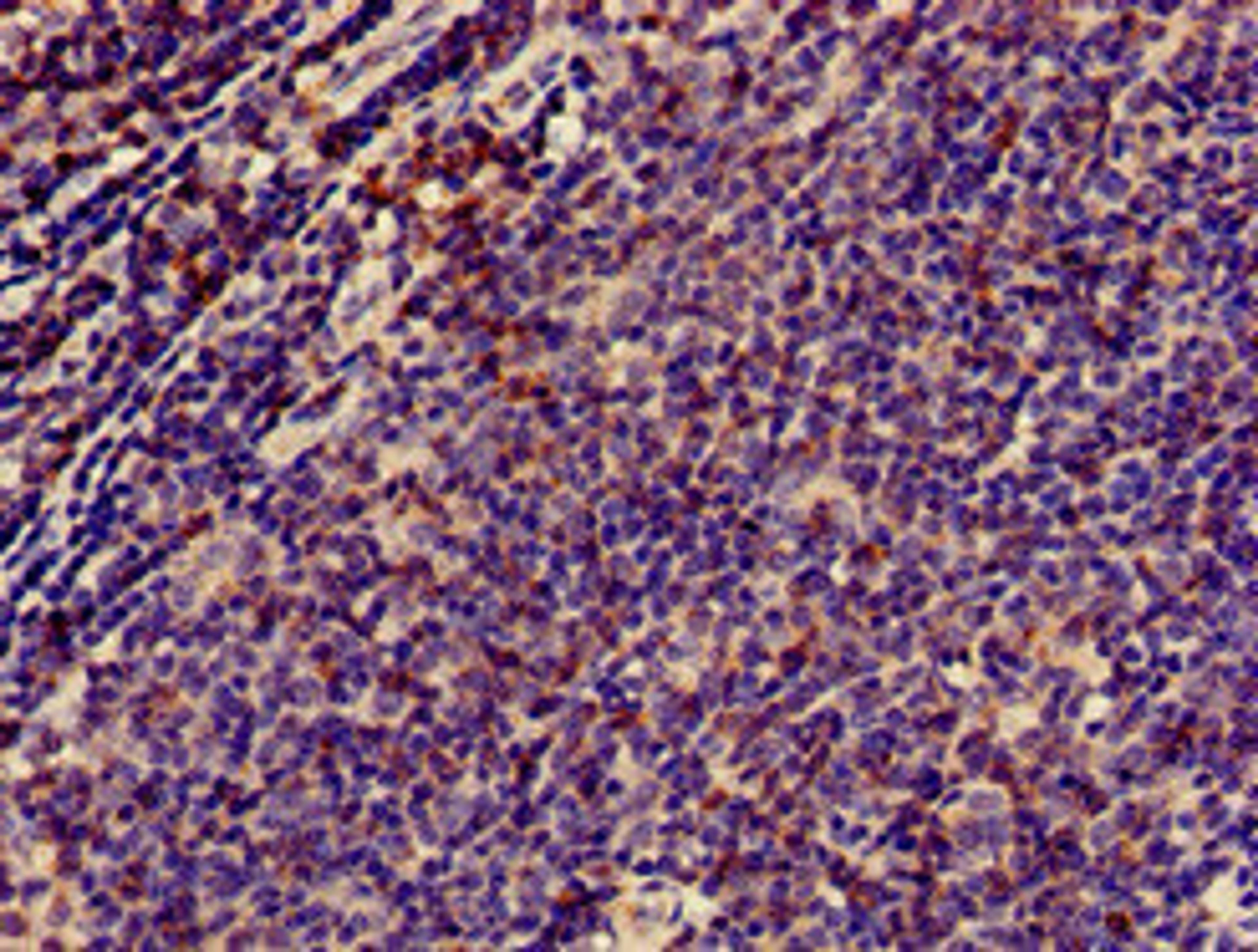 Immunohistochemistry of paraffin-embedded human lymph node tissue using CSB-PA004931HA01HU at dilution of 1:100
