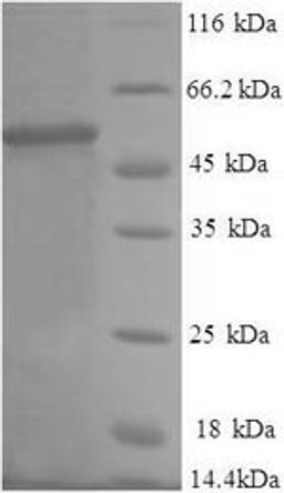 (Tris-Glycine gel) Discontinuous SDS-PAGE (reduced) with 5% enrichment gel and 15% separation gel.