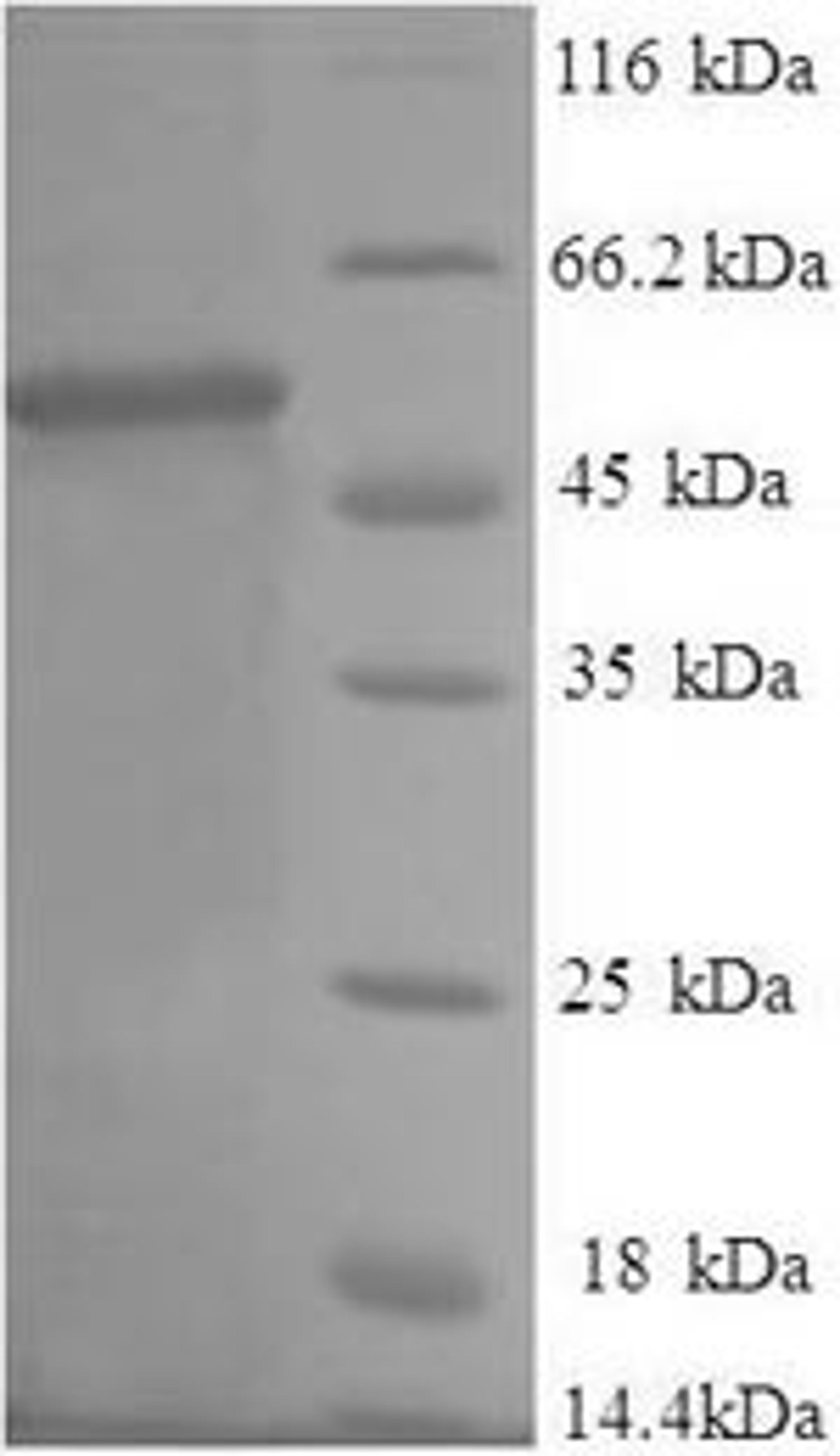 (Tris-Glycine gel) Discontinuous SDS-PAGE (reduced) with 5% enrichment gel and 15% separation gel.