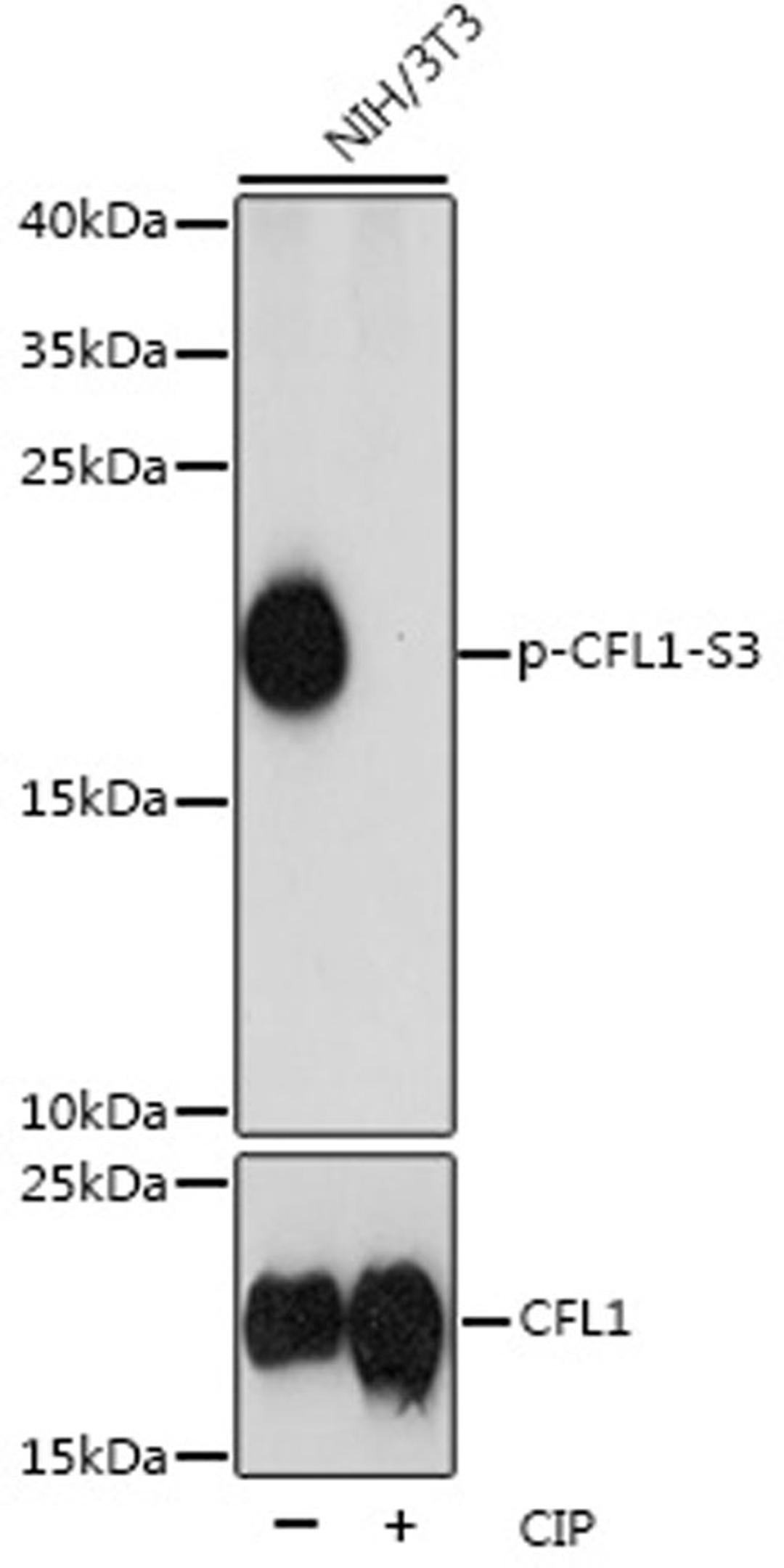 Western blot - Phospho-CFL1-S3 pAb (AP0178)