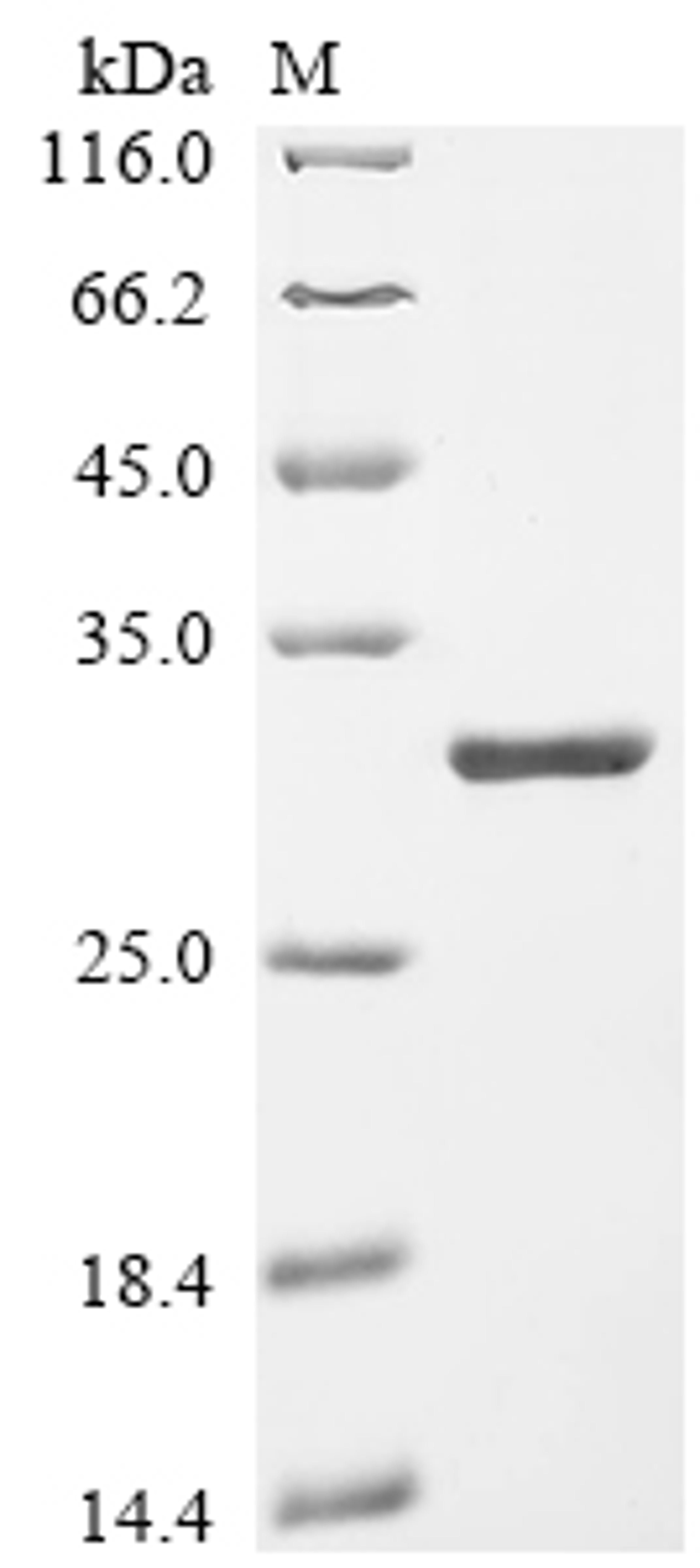 (Tris-Glycine gel) Discontinuous SDS-PAGE (reduced) with 5% enrichment gel and 15% separation gel.