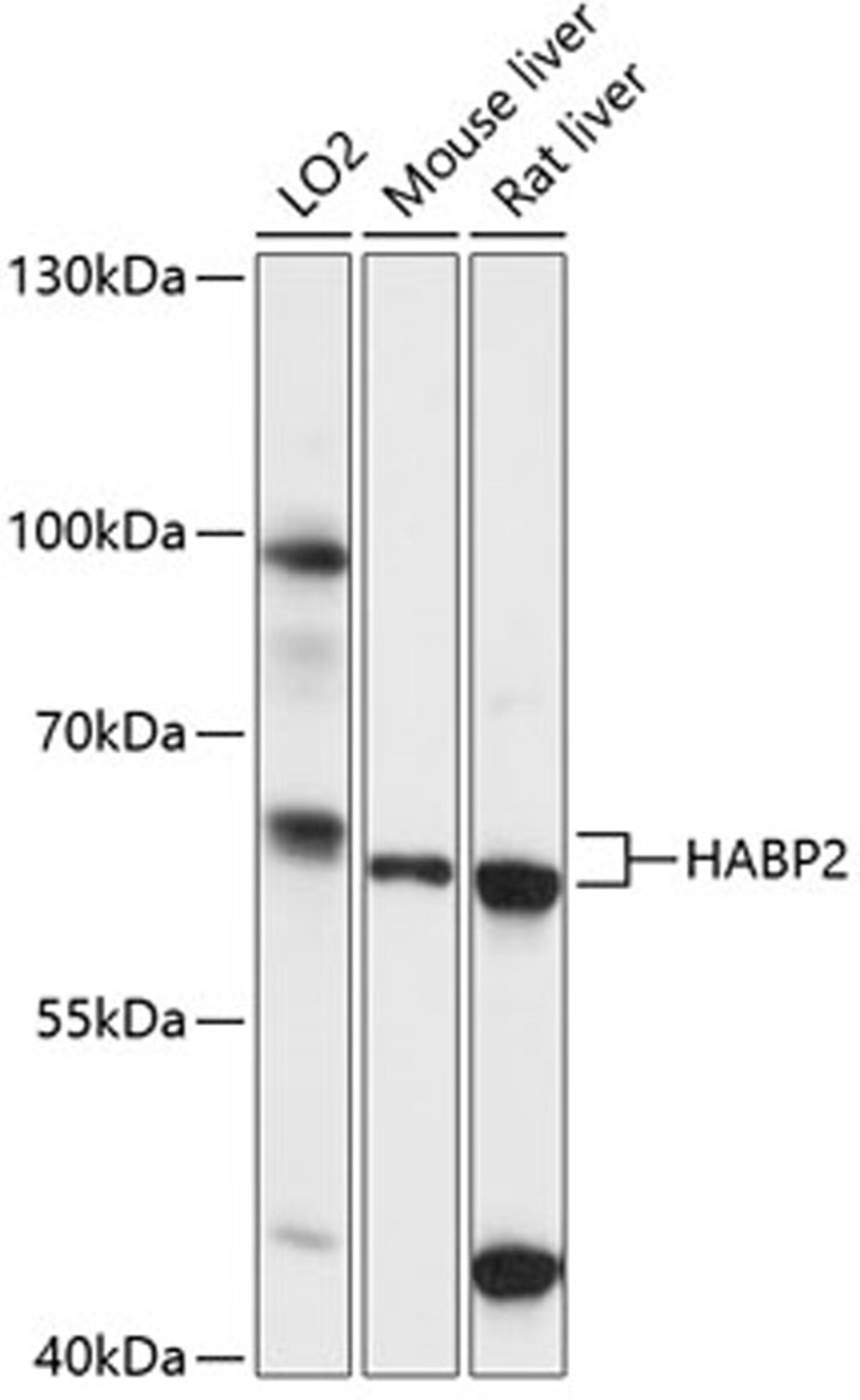 Western blot - HABP2 antibody (A14565)