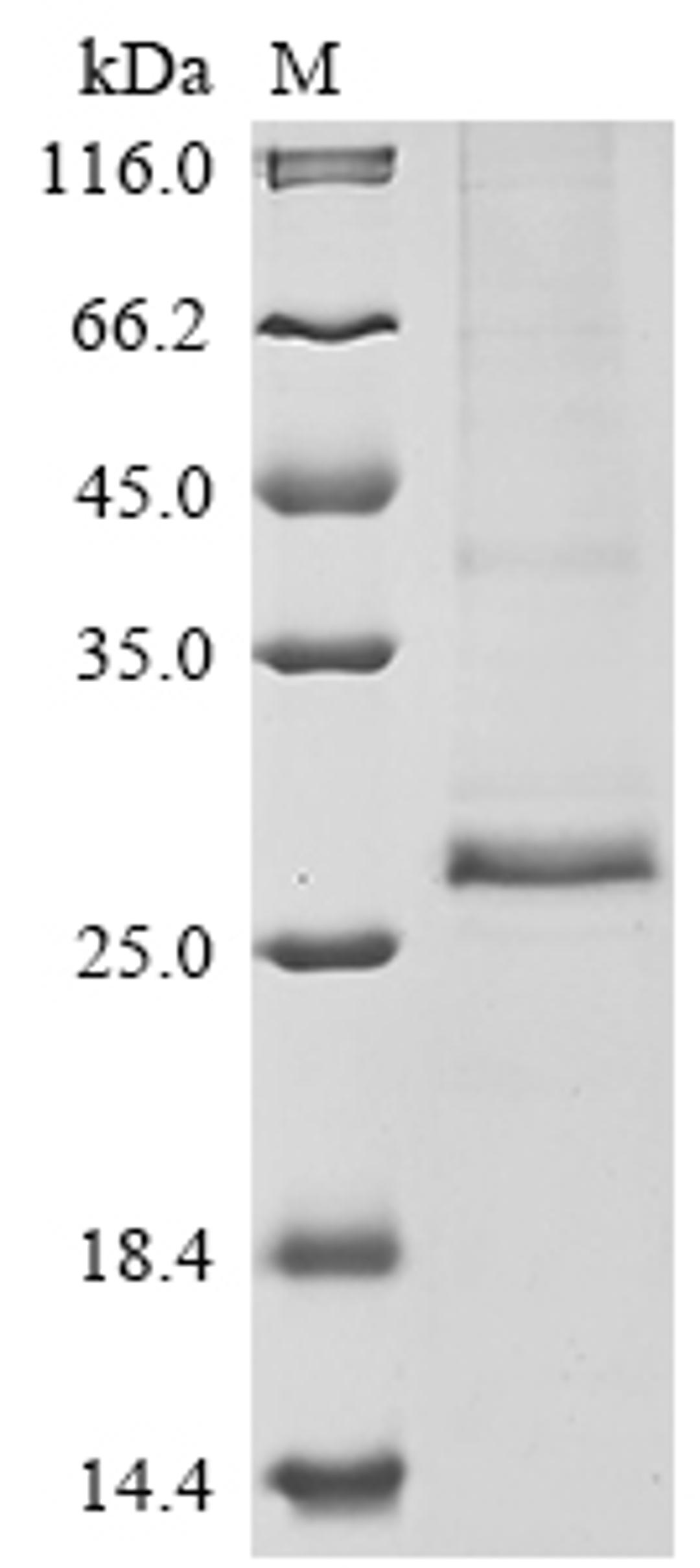 (Tris-Glycine gel) Discontinuous SDS-PAGE (reduced) with 5% enrichment gel and 15% separation gel.