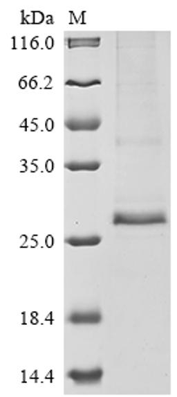 (Tris-Glycine gel) Discontinuous SDS-PAGE (reduced) with 5% enrichment gel and 15% separation gel.