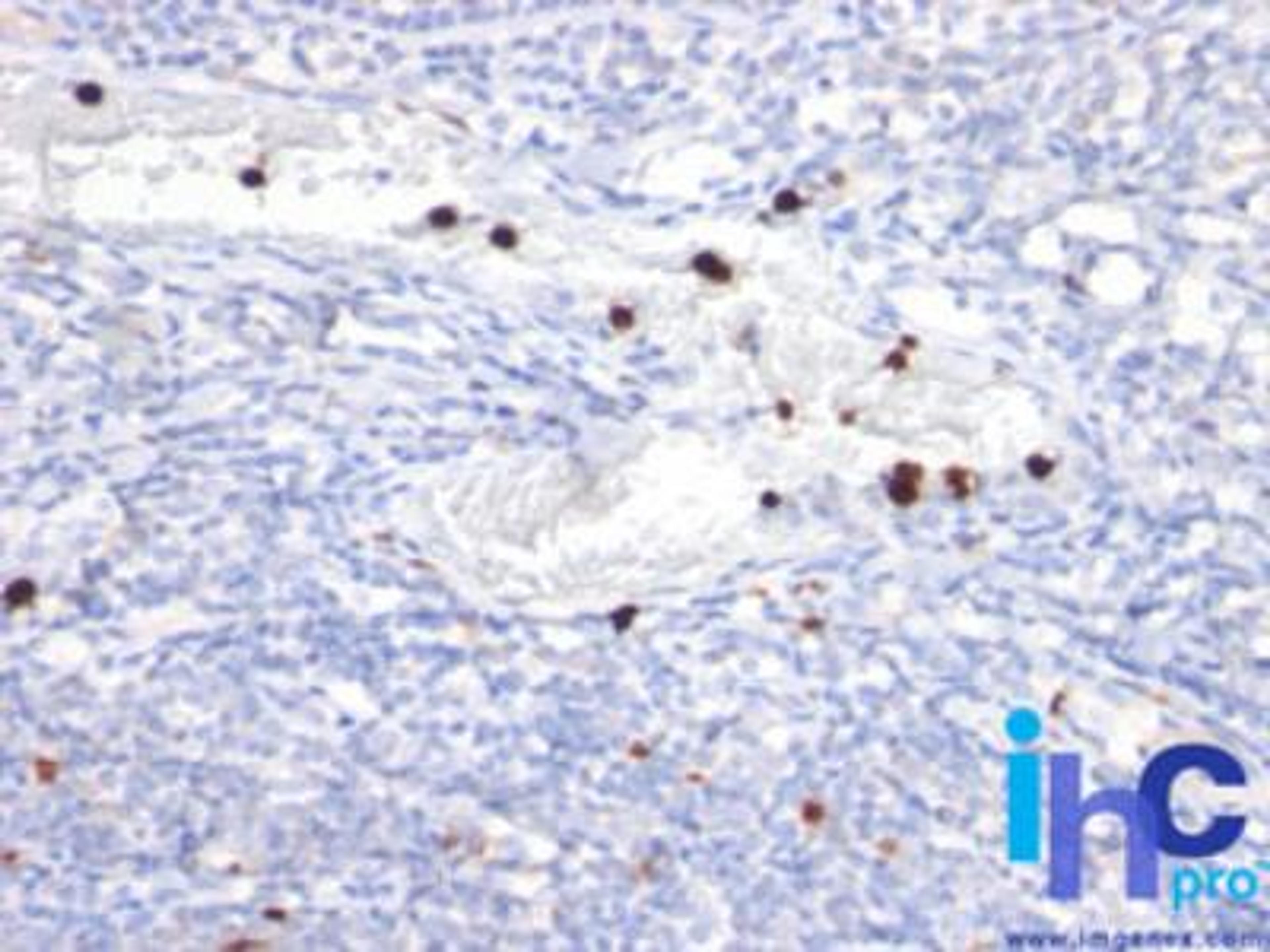 Immunohistochemistry-Paraffin: Granulocytes Antibody (BM-2) [NBP2-29470] - Formalin-fixed, paraffin-embedded human tonsil stained with Granulocyte antibody (1:200), peroxidase-conjugate and DAB chromogen. Note specific cytoplasmic staining.