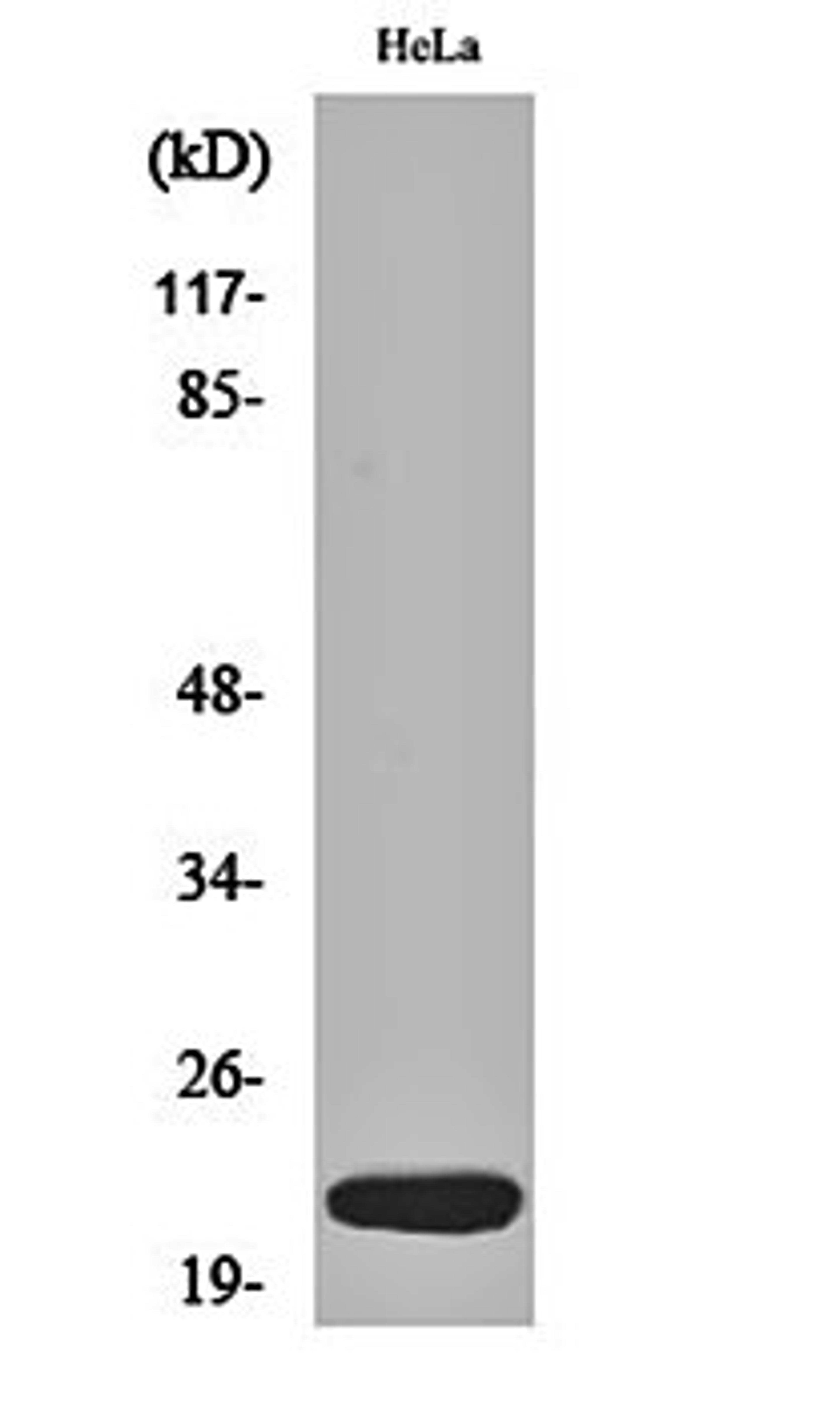 Western blot analysis of Hela cell lysates using Dynein LC 1 antibody