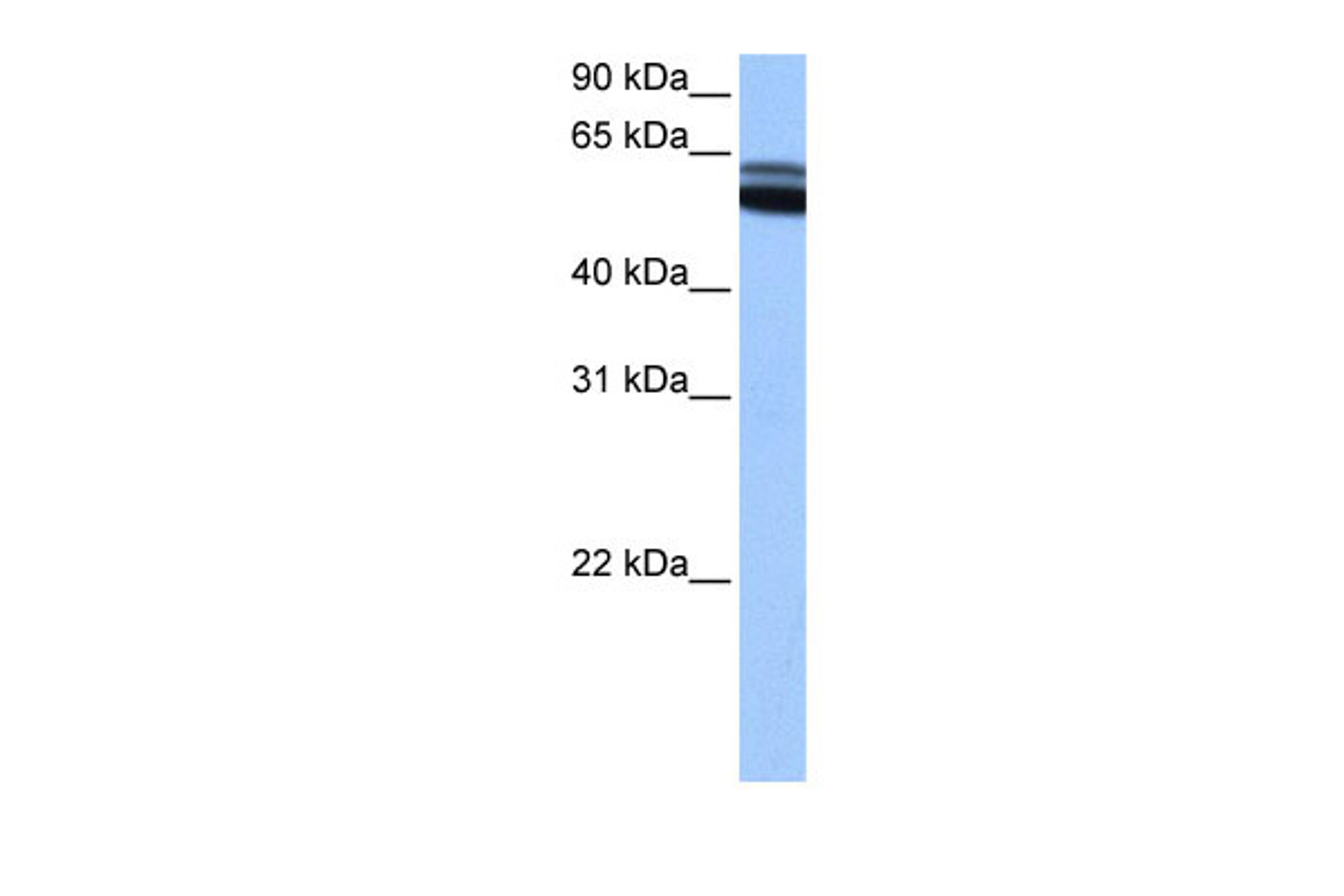 Antibody used in WB on Human brain at 0.2-1 ug/ml.