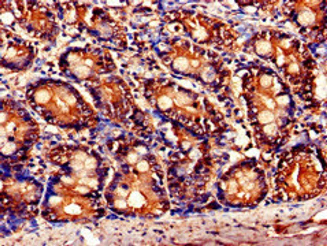 Immunohistochemistry of paraffin-embedded human small intestine tissue using CSB-PA622686LA01HU at dilution of 1:100