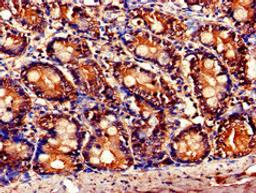 Immunohistochemistry of paraffin-embedded human small intestine tissue using CSB-PA622686LA01HU at dilution of 1:100