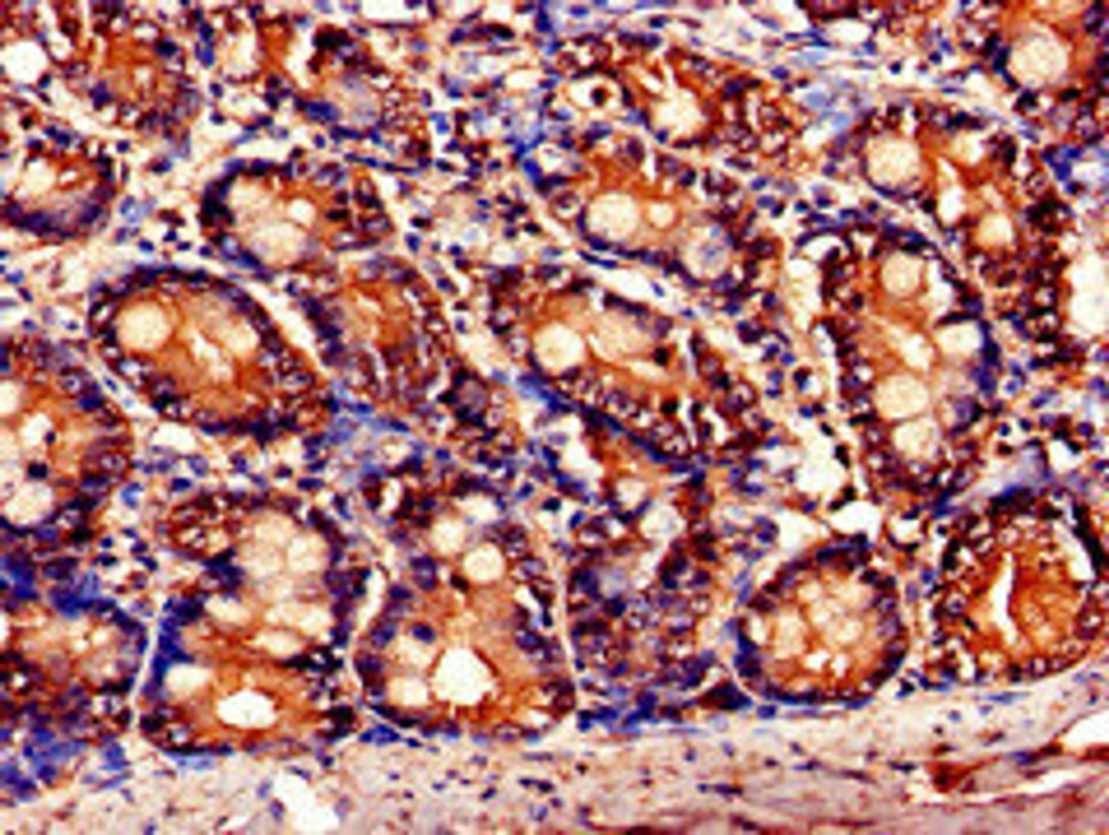 Immunohistochemistry of paraffin-embedded human small intestine tissue using CSB-PA622686LA01HU at dilution of 1:100