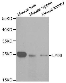 Western blot analysis of extracts of various cell lines using LY96 antibody