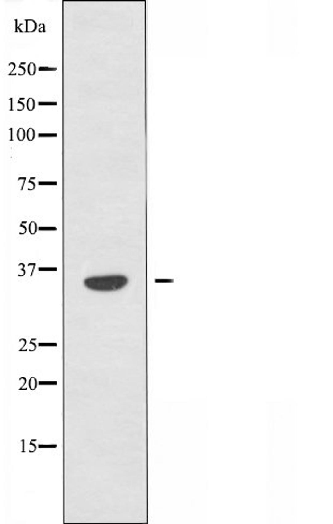 Western blot analysis of Jurkat cells using OR6A2 antibody