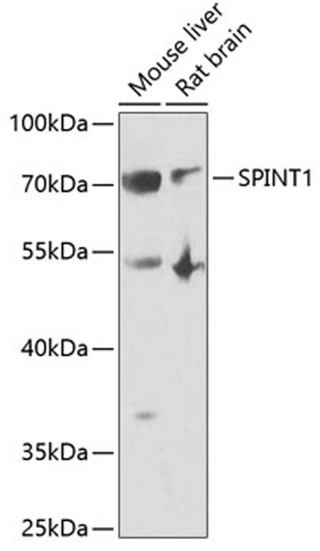 Western blot - SPINT1 antibody (A6411)