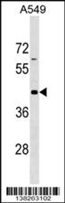 Western blot analysis in A549 cell line lysates (35ug/lane).