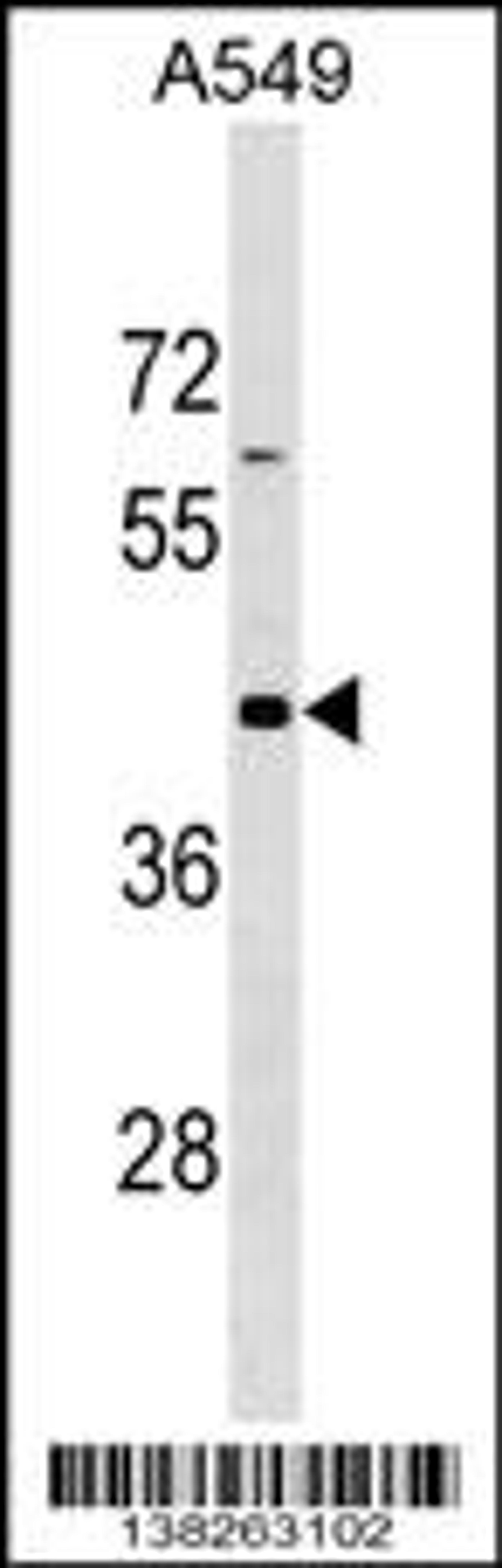 Western blot analysis in A549 cell line lysates (35ug/lane).