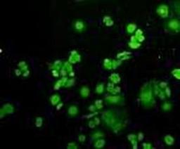 Immunofluorescence analysis of HepG2 cells (green) using Ubiquitin antibody