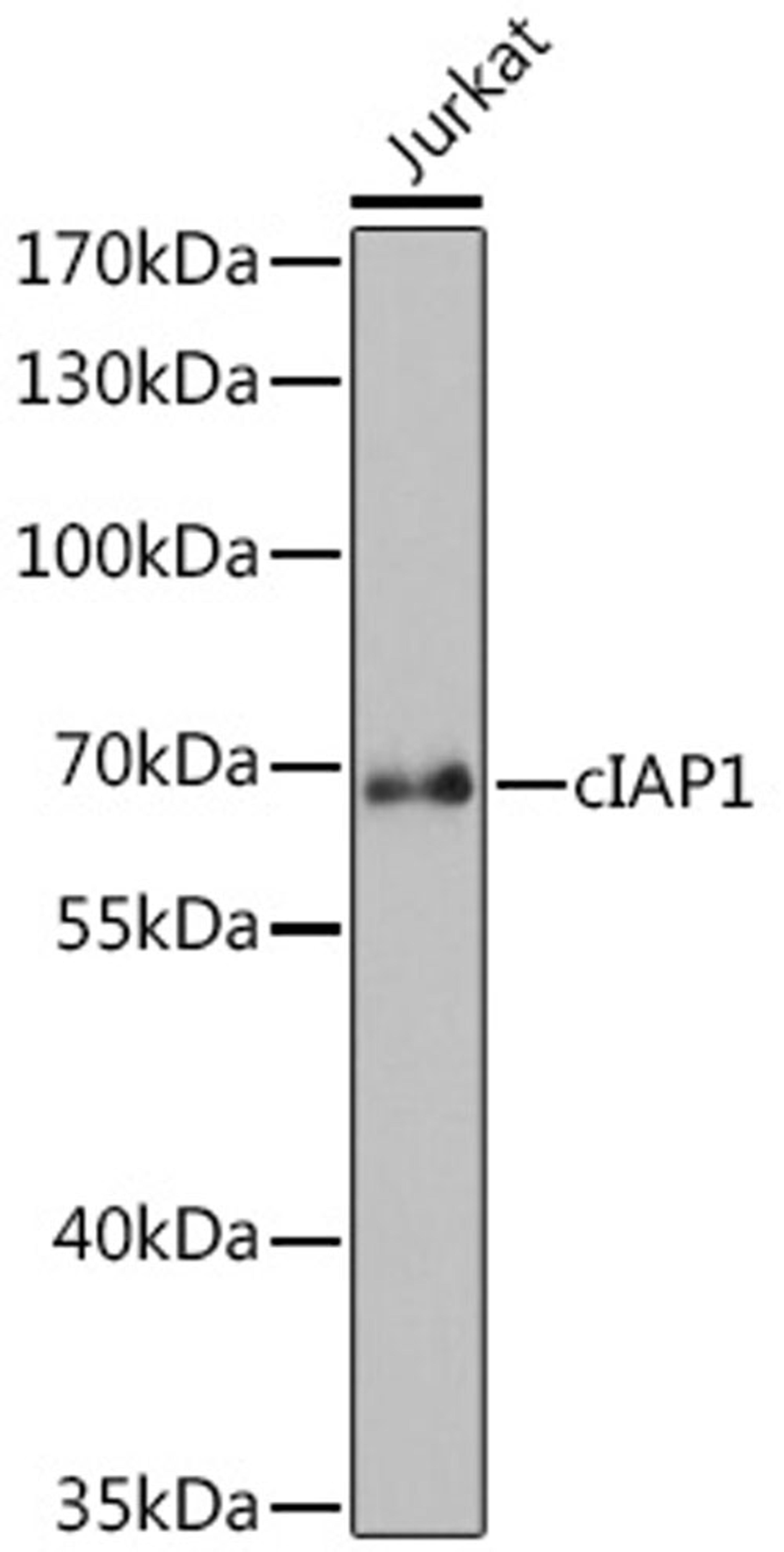 Western blot - cIAP1 antibody (A0985)