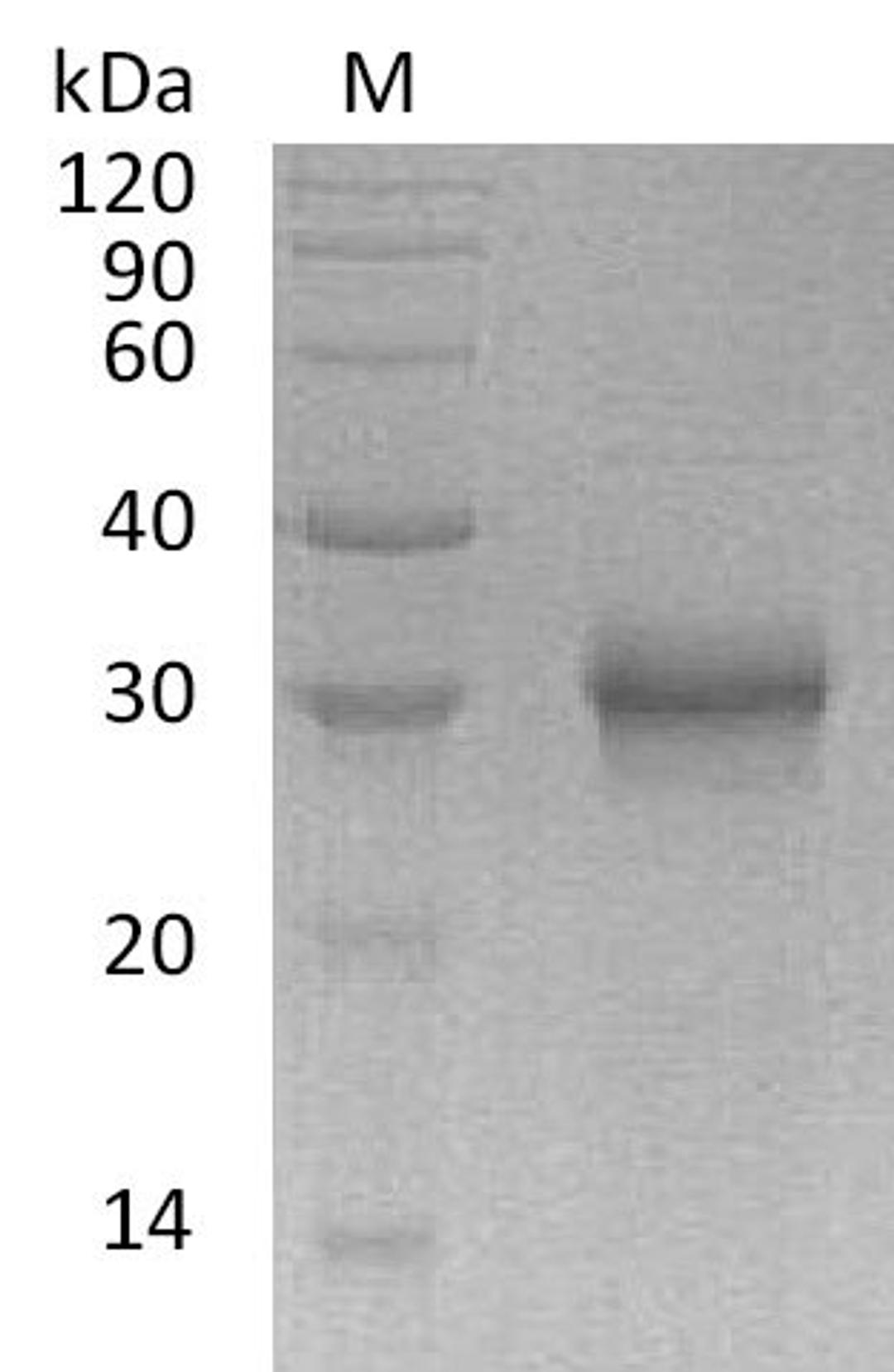 (Tris-Glycine gel) Discontinuous SDS-PAGE (reduced) with 5% enrichment gel and 15% separation gel.