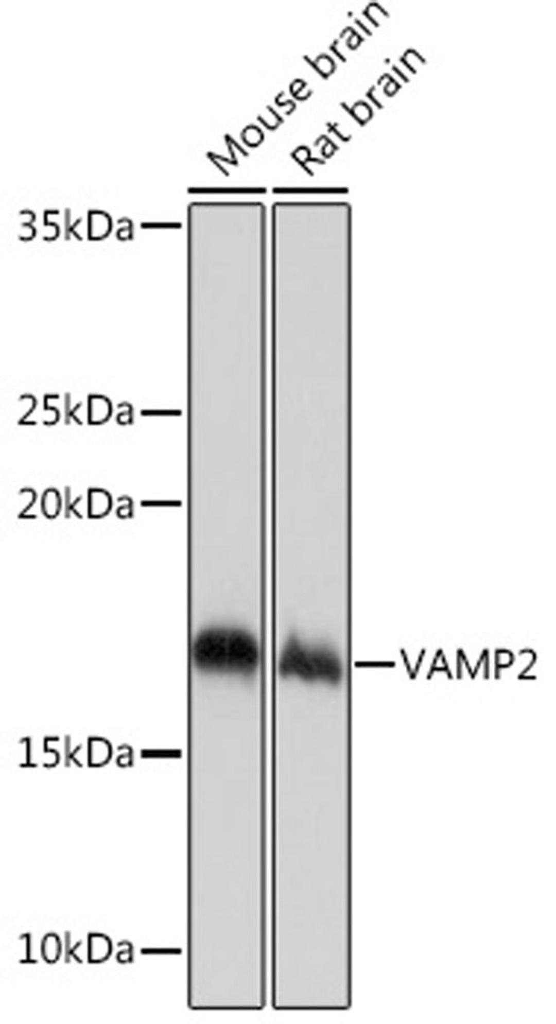 Western blot - VAMP2 Rabbit mAb (A4235)