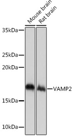 Western blot - VAMP2 Rabbit mAb (A4235)