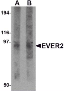 Western blot analysis of EVER2 in rat thymus tissue lysate with EVER2 antibody at (A) 1 and (B) 2 &#956;g/mL.