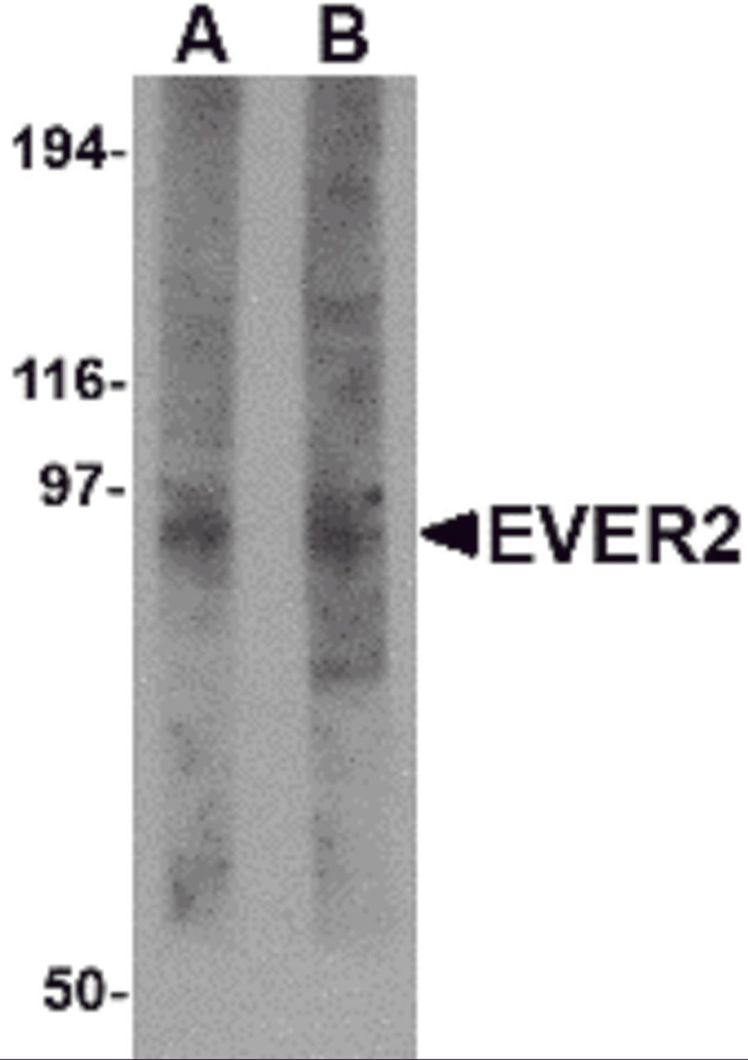 Western blot analysis of EVER2 in rat thymus tissue lysate with EVER2 antibody at (A) 1 and (B) 2 μg/mL.