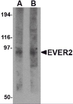 Western blot analysis of EVER2 in rat thymus tissue lysate with EVER2 antibody at (A) 1 and (B) 2 μg/mL.