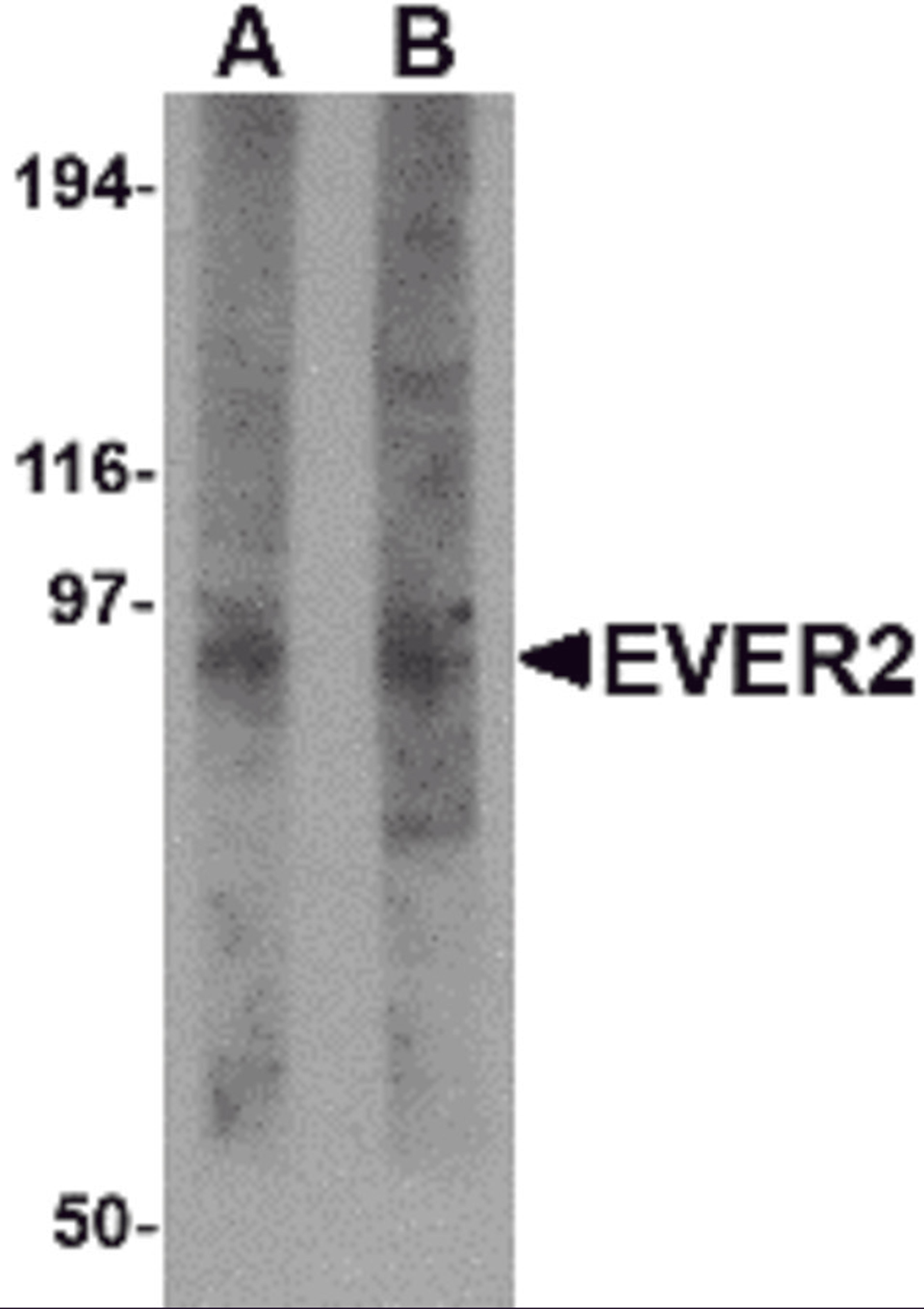 Western blot analysis of EVER2 in rat thymus tissue lysate with EVER2 antibody at (A) 1 and (B) 2 μg/mL.