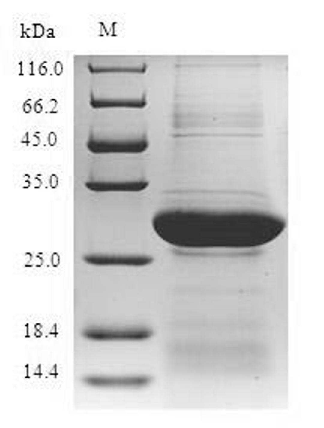 (Tris-Glycine gel) Discontinuous SDS-PAGE (reduced) with 5% enrichment gel and 15% separation gel.