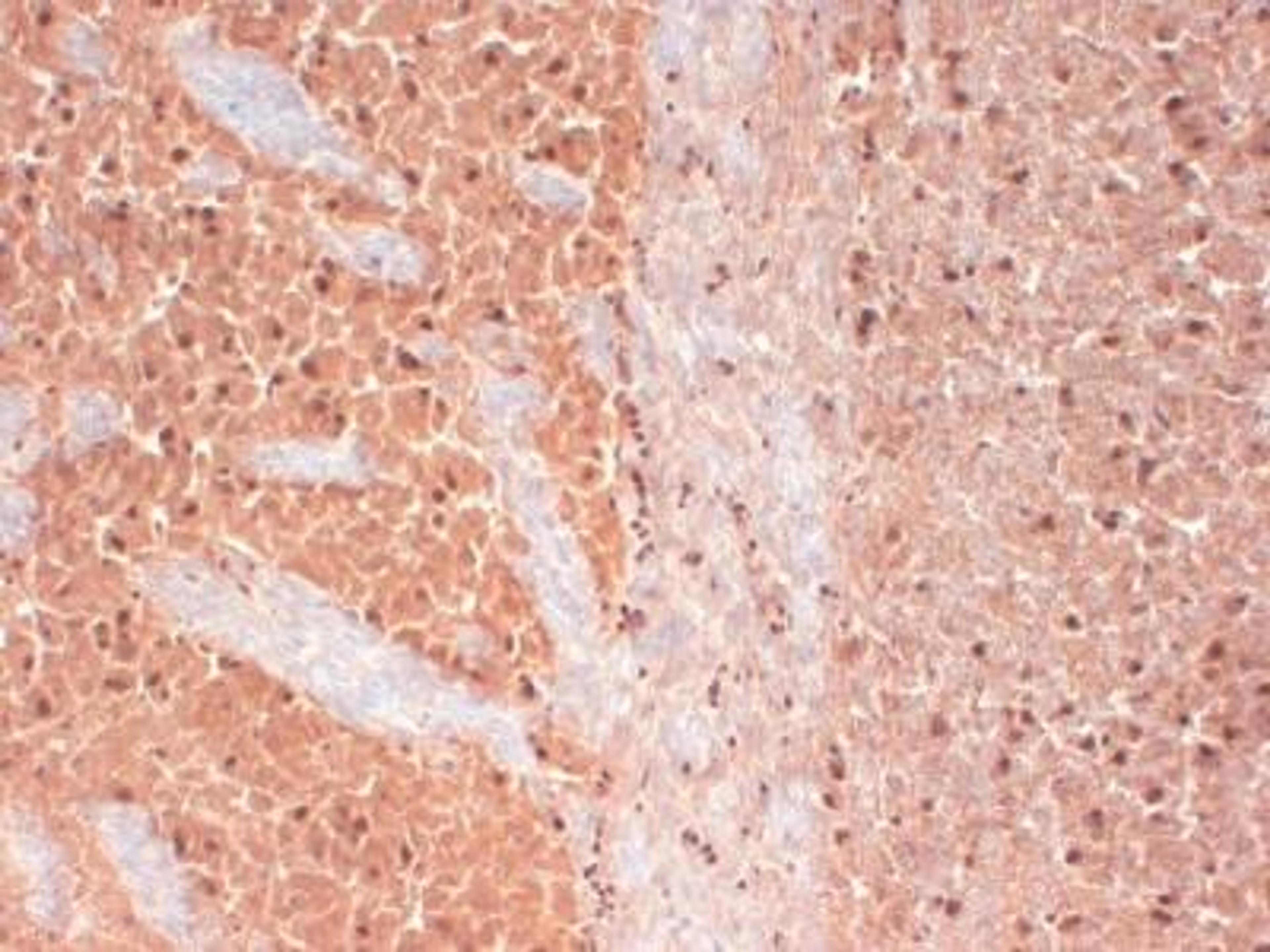 Immunohistochemistry-Frozen: Cav3.2 Antibody (S55-10) [NBP1-22444] - Frozen sections of mouse brain extract.