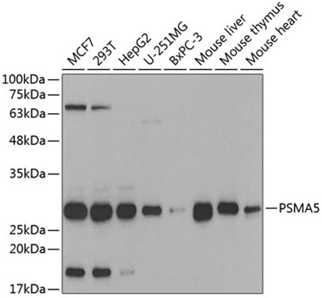 Western blot - PSMA5 antibody (A5752)