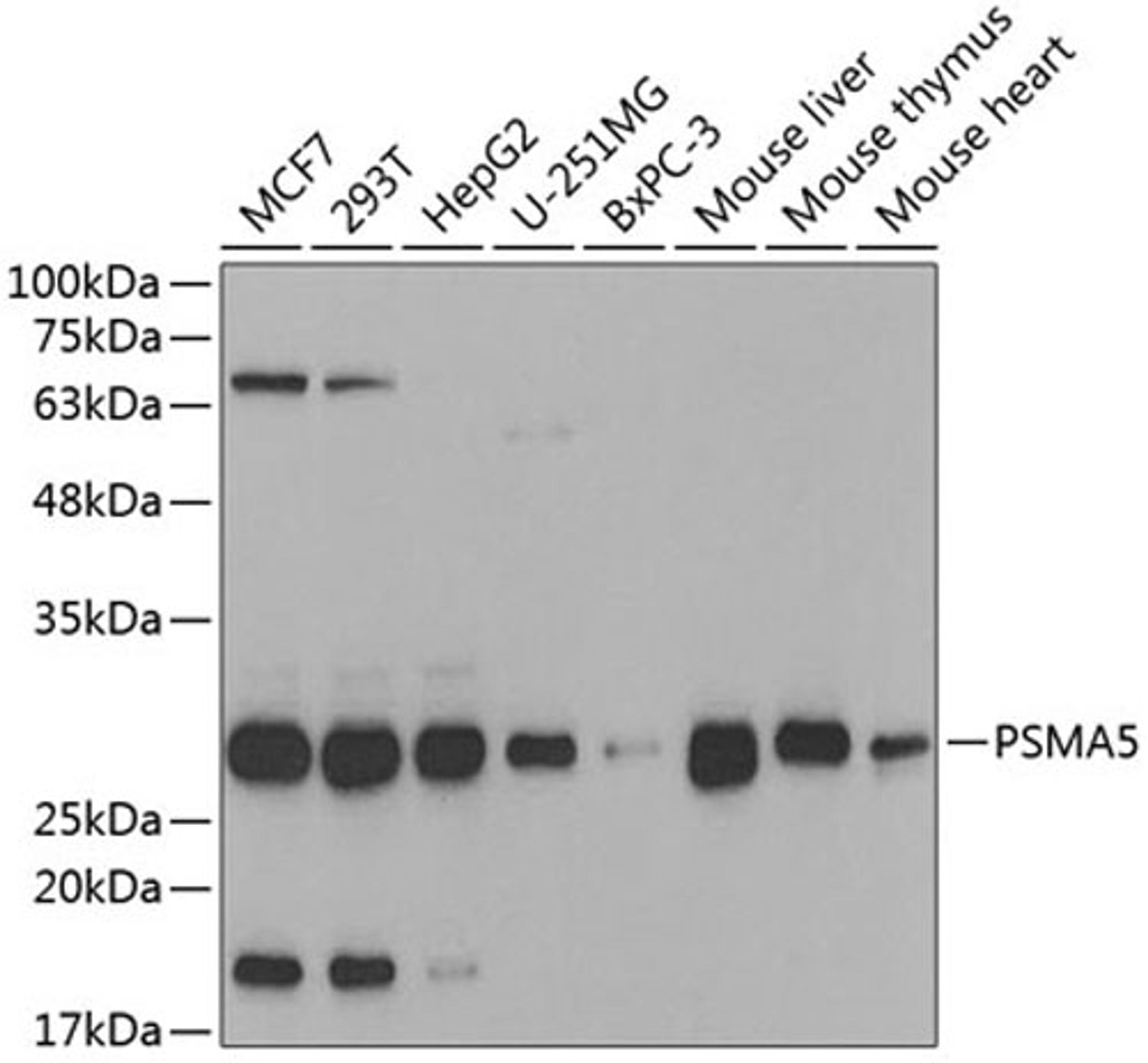 Western blot - PSMA5 antibody (A5752)