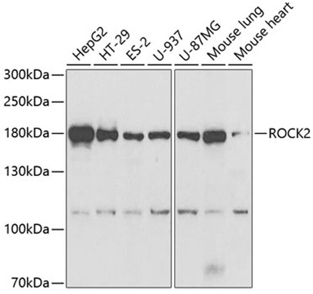 Western blot - ROCK2 antibody (A5698)