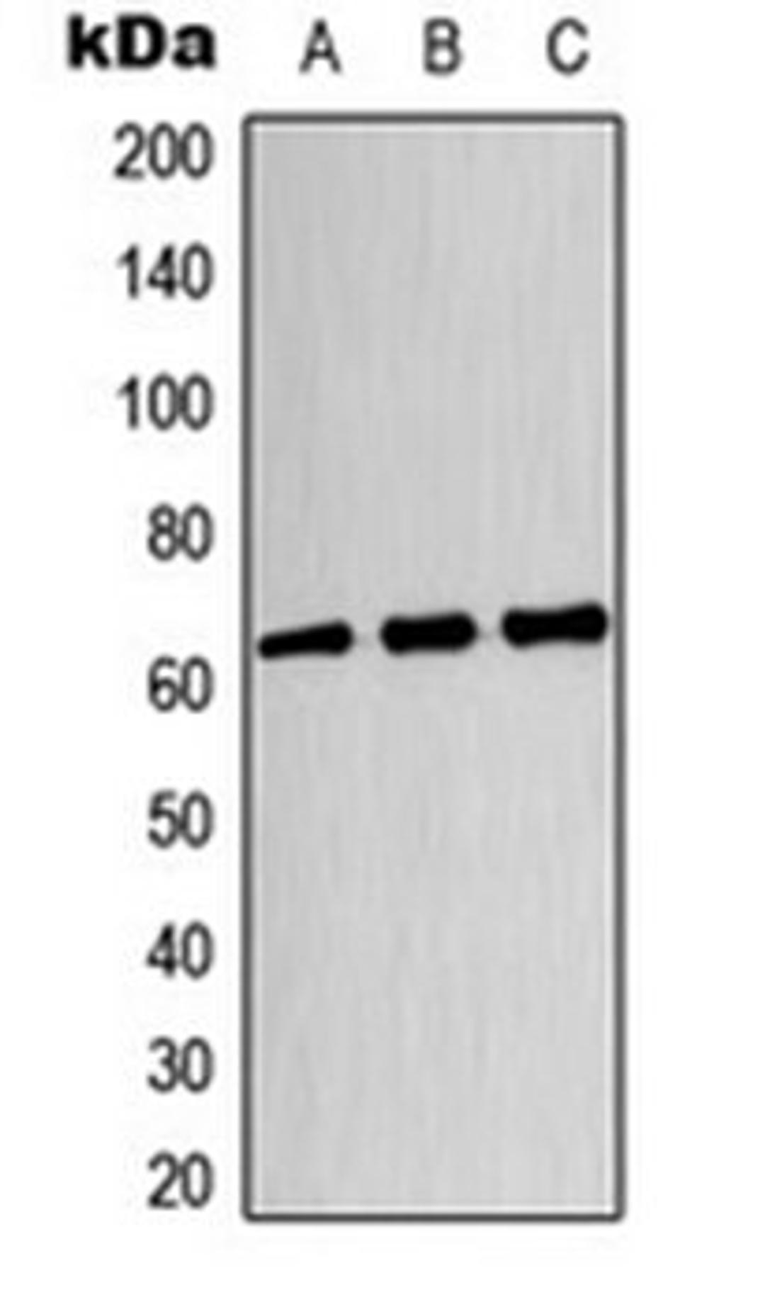 Western blot analysis of HeLa (Lane 1), U87MG (Lane 2), HT29 (Lane 3) whole cell lysates using CRMP3 antibody