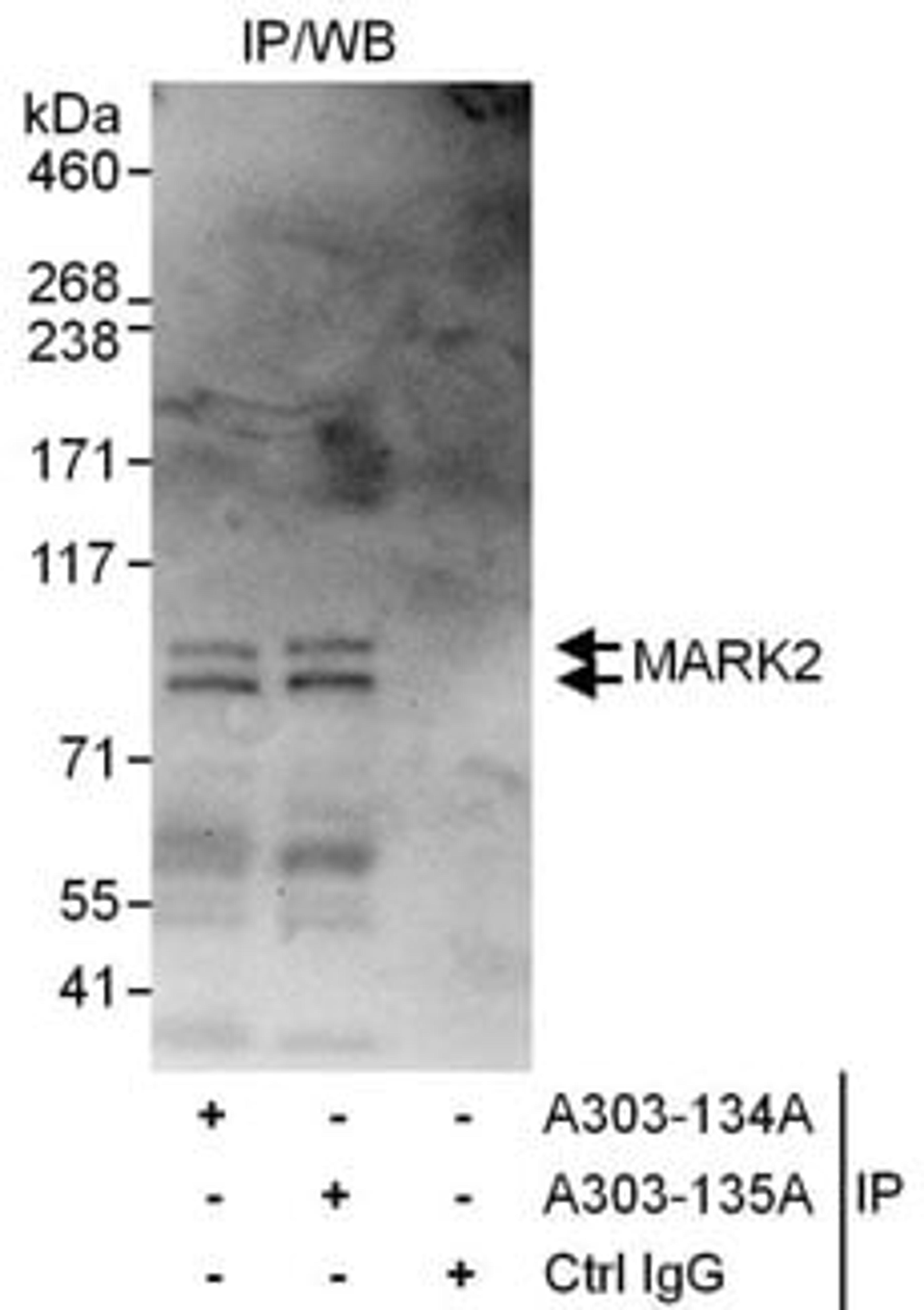 Detection of human MARK2 by western blot of immunoprecipitates.