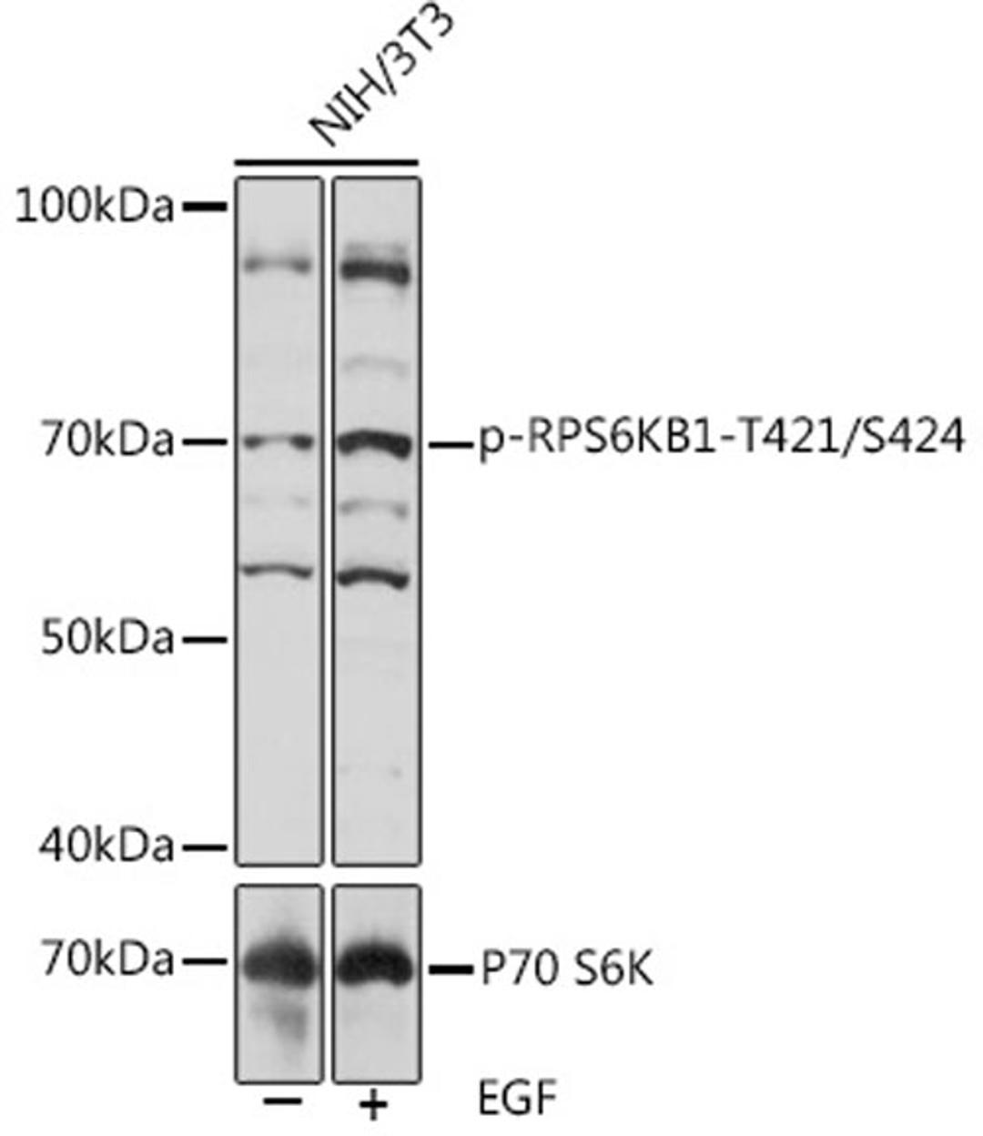 Western blot - Phospho-RPS6KB1-T421/S424 pAb (AP1106)