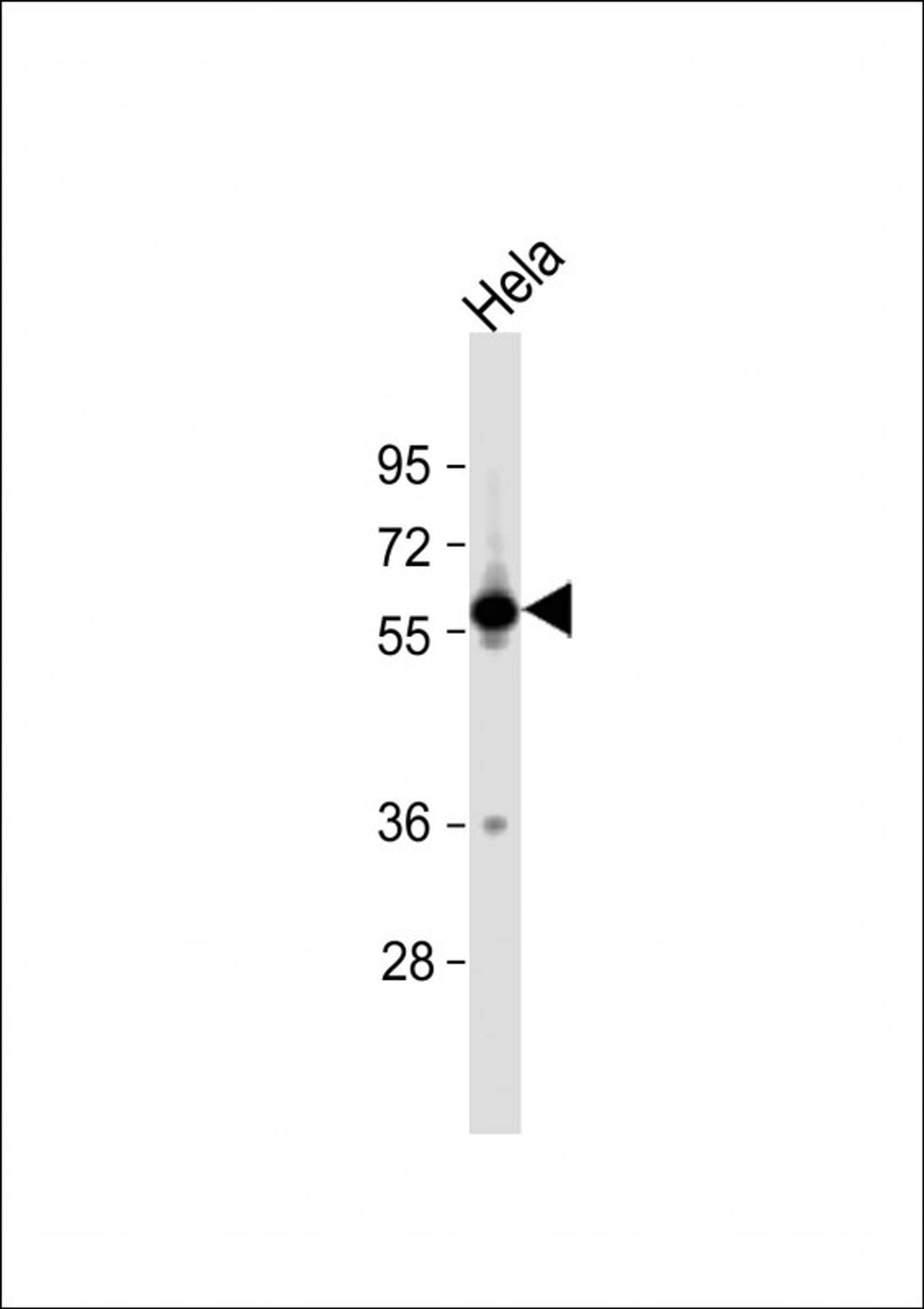 Western Blot at 1:1000 dilution + Hela whole cell lysate Lysates/proteins at 20 ug per lane.